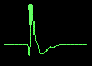 Neuromuscular